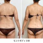 モンテビフォーアフター