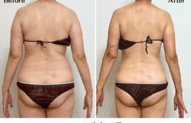 モンテビフォーアフター