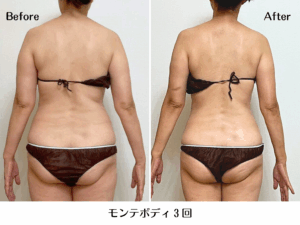 モンテビフォーアフター