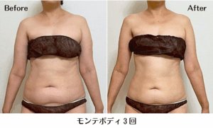 モンテビフォーアフター