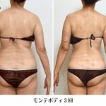 モンテビフォーアフター