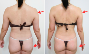 モンテビフォーアフター