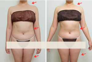 モンテビフォーアフター