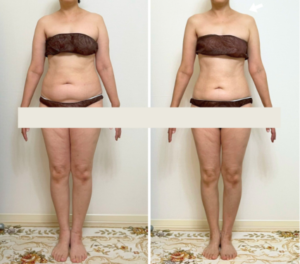 モンテビフォーアフター